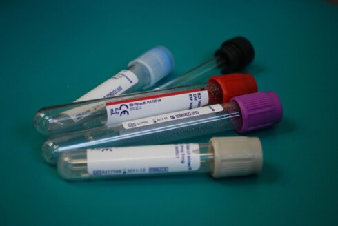 2020-04-07 00:00:00 - Testkits voor bewoners en zorgpersoneel in woonzorgcentra